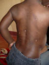 Godfrey's scars